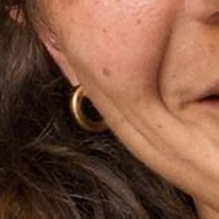 Zlatá obrúčka leží na líci, pod ňou nie je ucho.